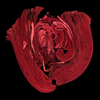 Cara Barer - Heart Sizes vary